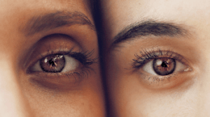 contorno de ojos