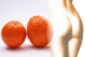 piel de naranja en celulitis