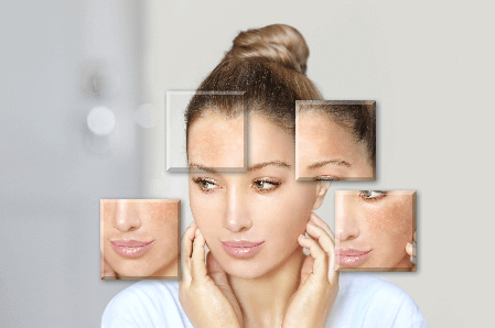 Diferentes tipos de manchas faciales