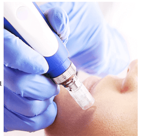 comprar dermapen profesional