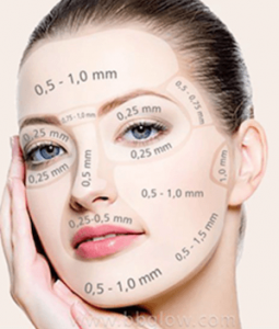 dermapen en casa profundidad agujas