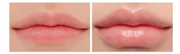 Mejor voluminizador de labios