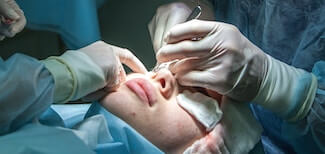 Blefaroplastia