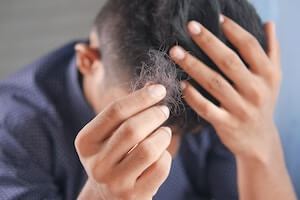 Alopecia, causas y tratamientos